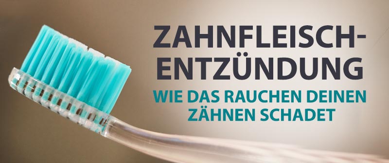 Zahnfleischentzündung – Wie das Rauchen Deinen Zähnen schadet